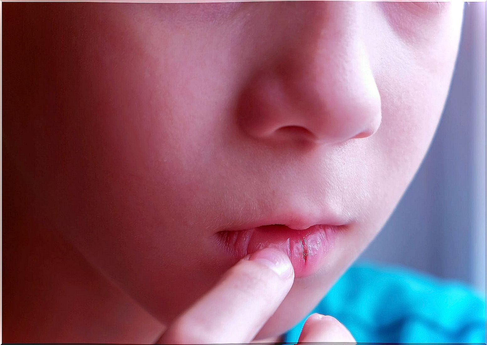 Child with chapped lips.