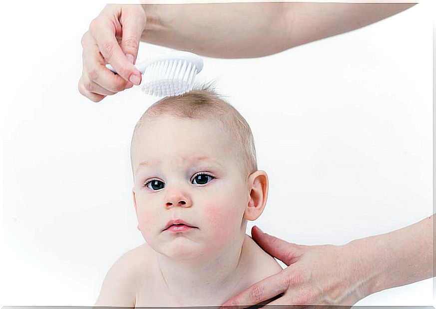 What is baby cradle cap?